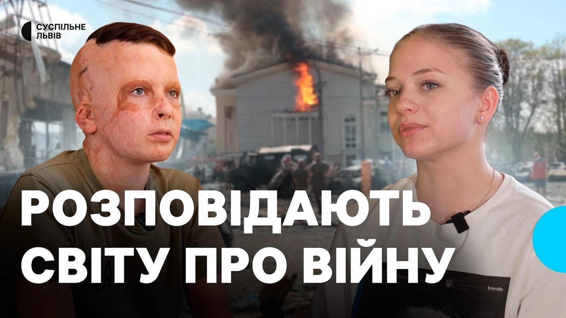 Яна Степаненко та Роман Олексів — амбасадори центру «Unbroken» у Львові, постраждалі від російських обстрілів