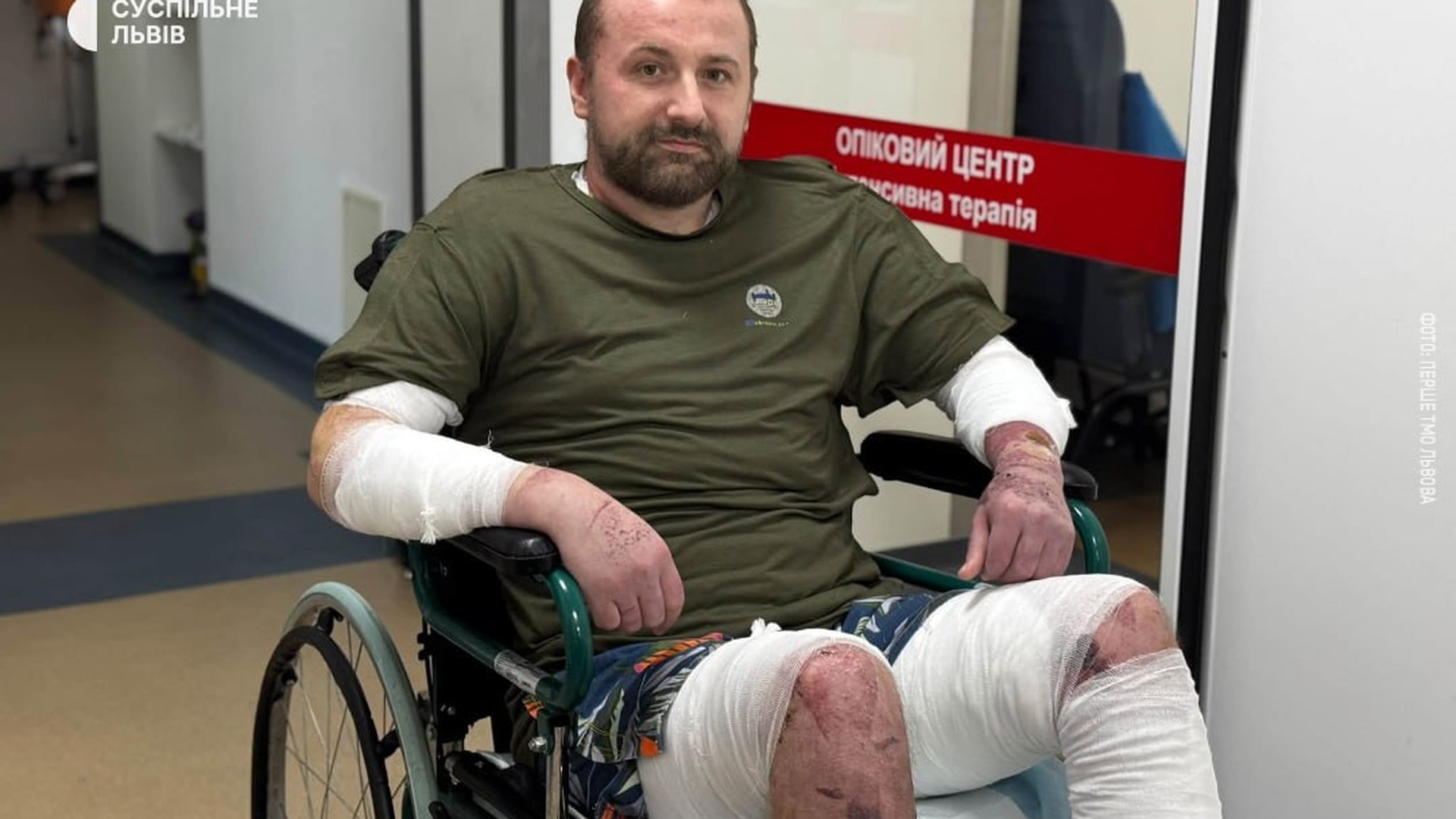 Медики Першого ТМО Львова врятували чоловіка з опіками 80% тіла після вибуху бойлера у квартирі