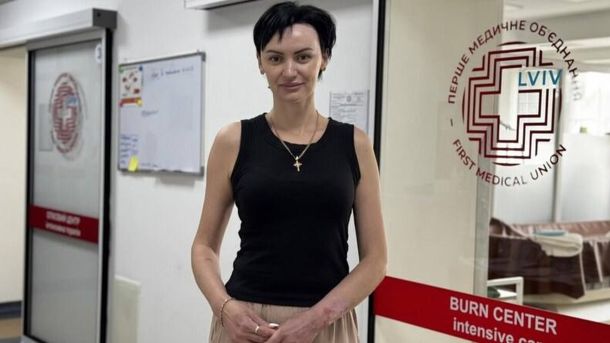 Медики центру термічної травми лікарні святого Луки у Львові надають допомогу одеситці Євгенії з опіками 45% тіла після удару шахеда