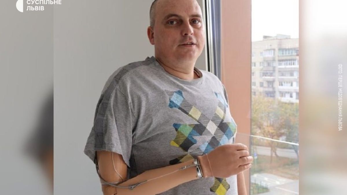 Військовослужбовець Олег Трофімчук із Волині проходить реабілітацію з протезом руки у центрі Unbroken у Львові після 15 операцій